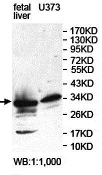 KIAA0513 Rabbit Polyclonal Antibody