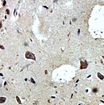KIAA0513 Rabbit Polyclonal Antibody