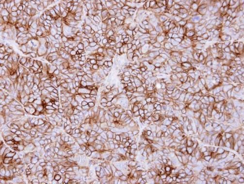 KIDINS220 antibody [C3], C-term