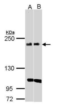 KIDINS220 antibody [C3], C-term