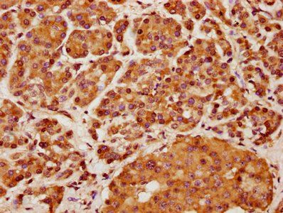 KIF13A Antibody