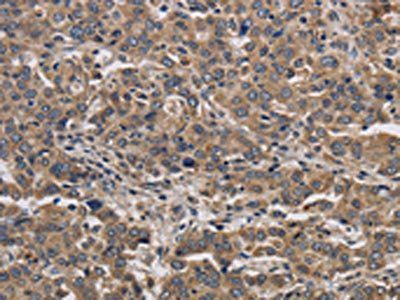 KIF22 Antibody