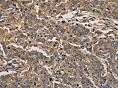 KIF22 Antibody