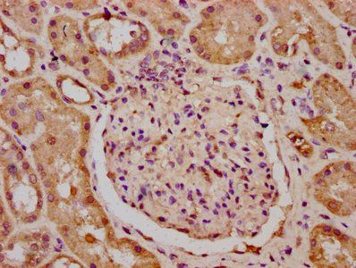 KIF23 Antibody