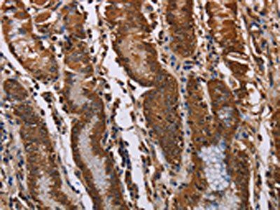 KIF2A Antibody