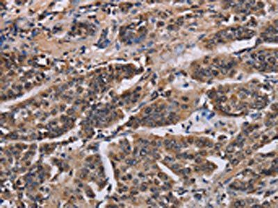 KIF2A Antibody