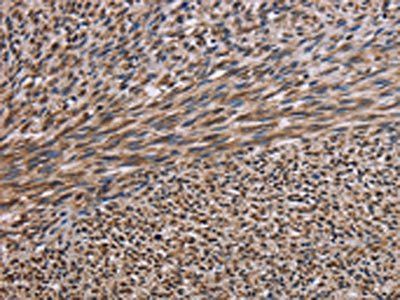 KIF2A Antibody