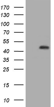 FERMT2 Antibody
