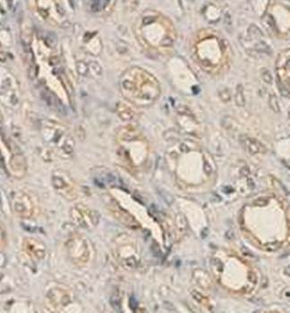 Kinesin 1 Rabbit Polyclonal Antibody