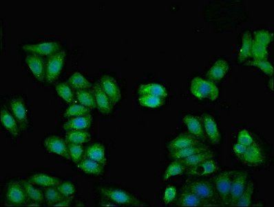 KNG1 Antibody