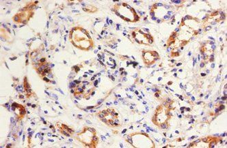 KNG1 Antibody