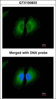 kininogen 1 Antibody