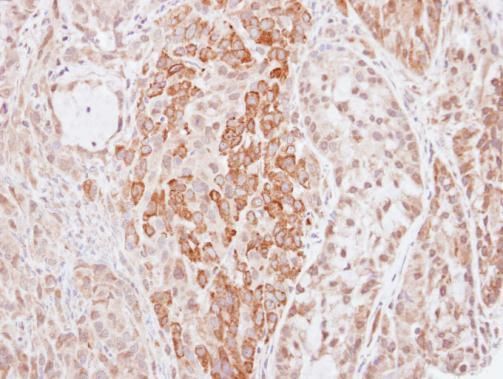 kininogen 1 Antibody