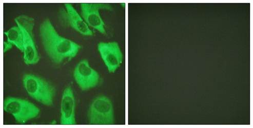 Kir5.1 (Ab-416) Antibody