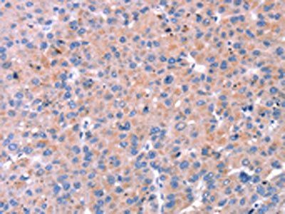 KISS1R Antibody