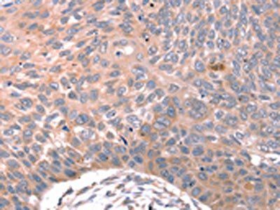 KISS1R Antibody