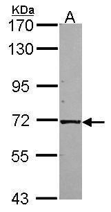 IVD Rabbit Polyclonal Antibody
