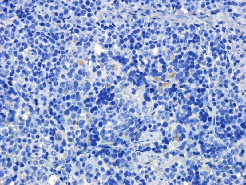 KLF2 antibody
