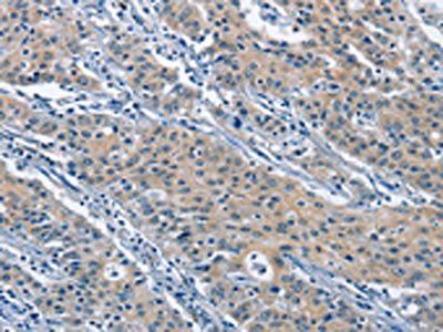 KLF7 Antibody