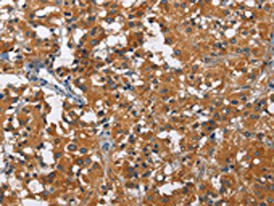 KLF7 Antibody