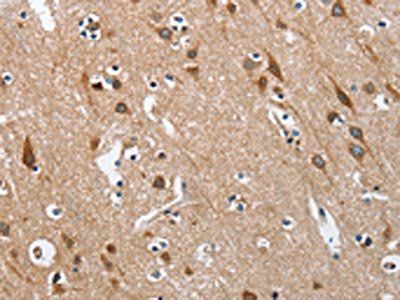 KLF7 Antibody