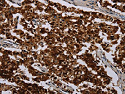 KLK11 Antibody