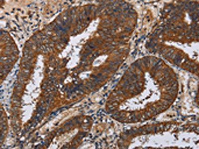 KLK11 Antibody