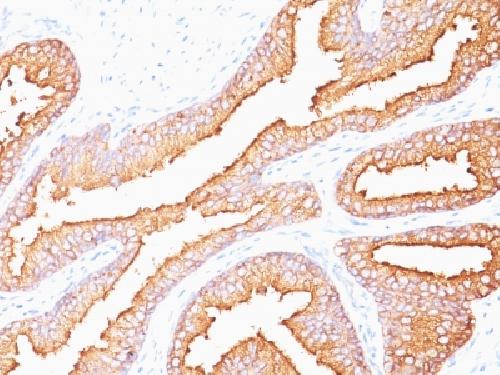 KLK3 Antibody