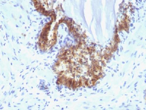 KLK3 Antibody