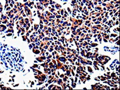 KLK3 Antibody