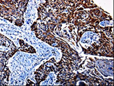 KLK3 Antibody