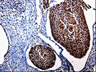 KLK3 Antibody