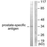 KLK3 Antibody