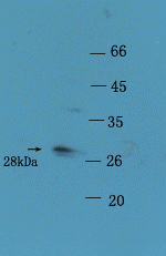 KLK4 Rabbit Polyclonal Antibody
