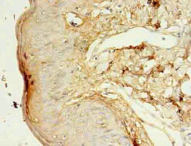 KLK5 Antibody