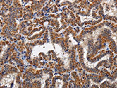 KLK6 Antibody