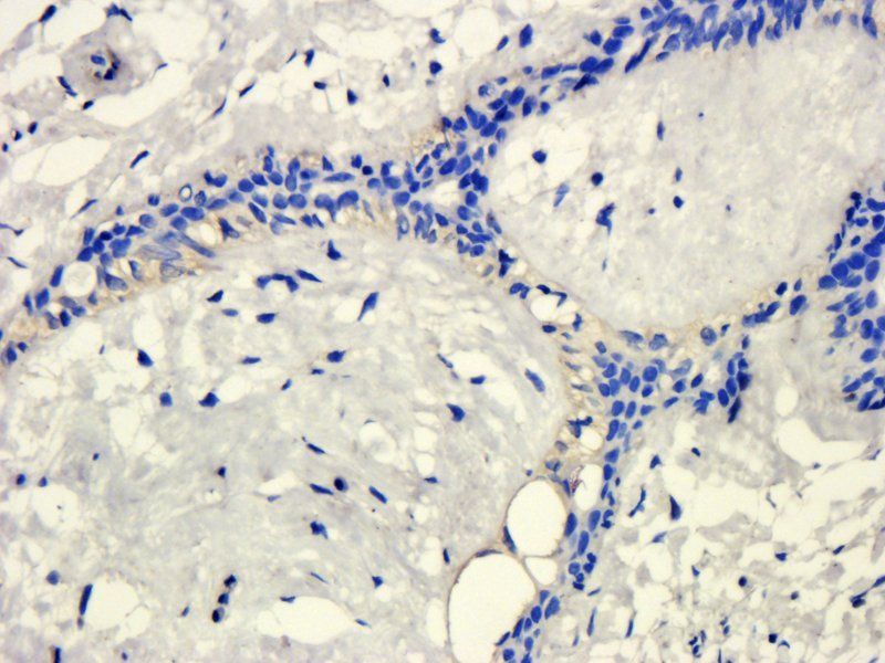 KLKB1 antibody