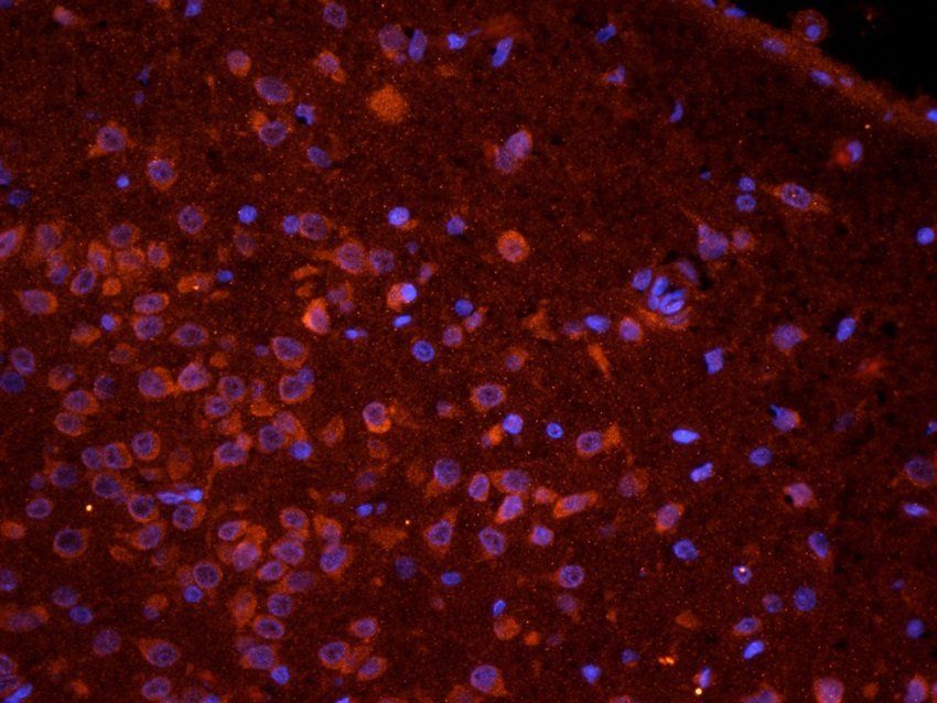KLRC2 Rabbit Polyclonal Antibody