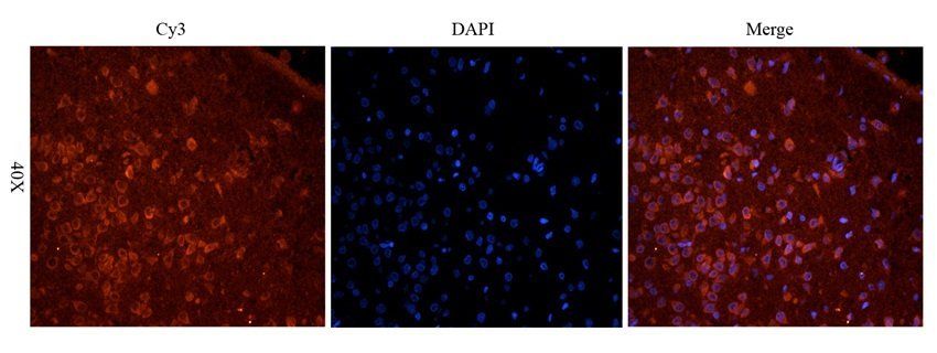 KLRC2 Rabbit Polyclonal Antibody