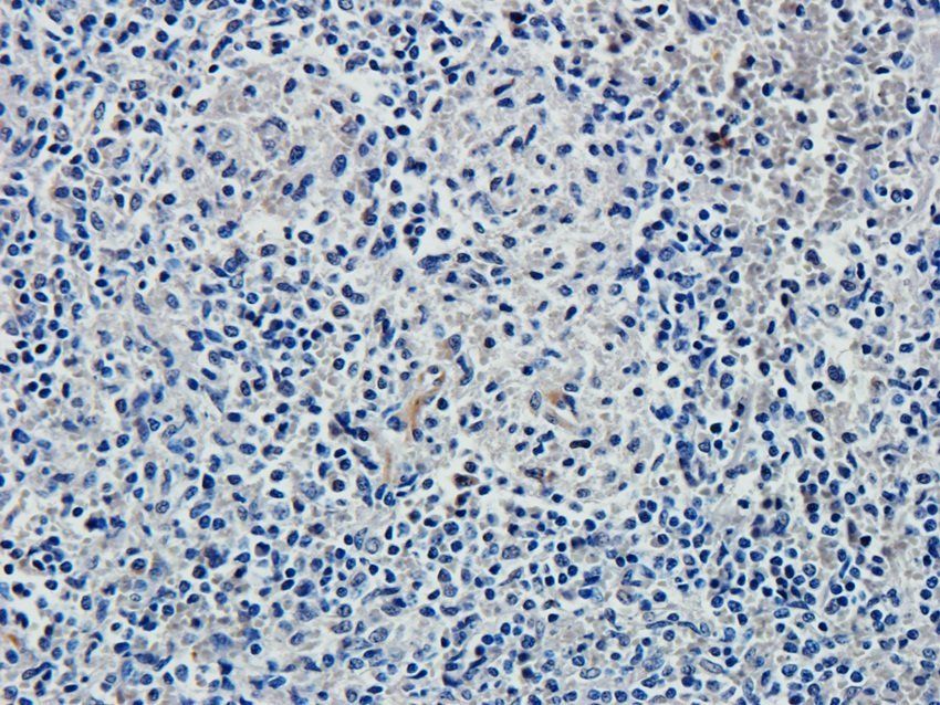 KLRC2 Rabbit Polyclonal Antibody