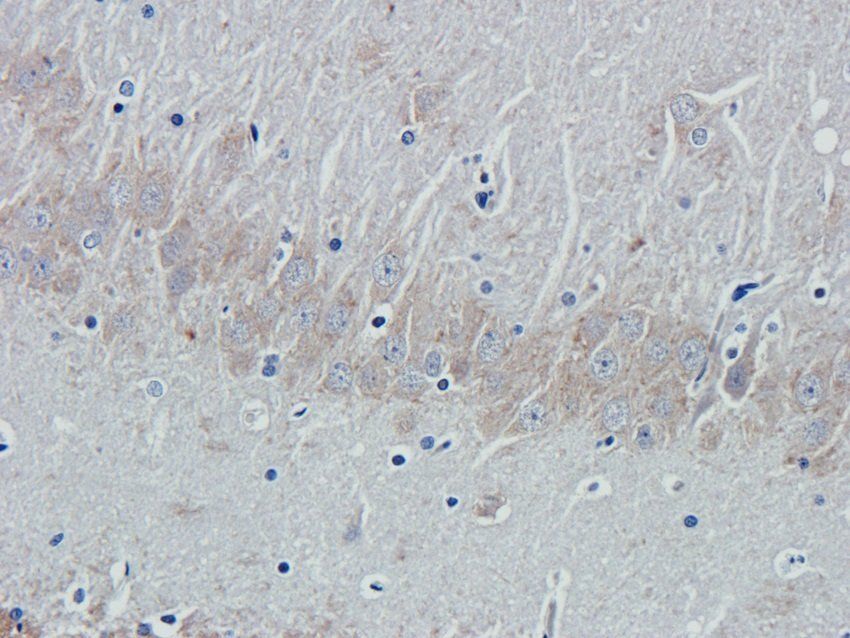 KLRC2 Rabbit Polyclonal Antibody