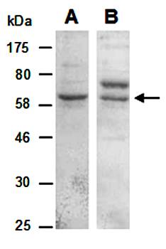 KLRG1 (vPairTM) Antibodies