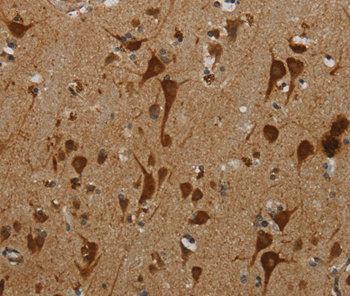 KMT2B Antibody