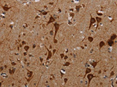 KMT2D Antibody