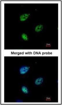 KPNA4 Rabbit Polyclonal Antibody