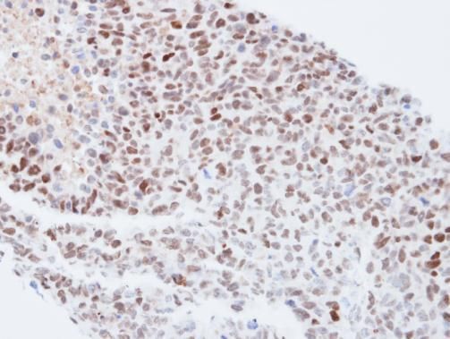 KPNA4 Rabbit Polyclonal Antibody