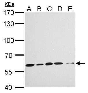 KPNA4 Rabbit Polyclonal Antibody
