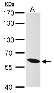 KPNA4 Rabbit Polyclonal Antibody