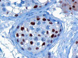 KPNA4/IPOA3 Antibody