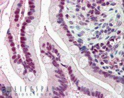 KPNA4/IPOA3 Antibody
